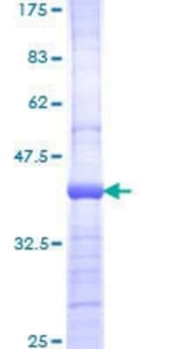 Novus Biologicals Recombinant Human PI 3-Kinase p110 beta/PIK3CB GST (N-Term) Protein 10 &mu;g | Buy Online | Novus Biologicals&trade; | Fisher Scientific