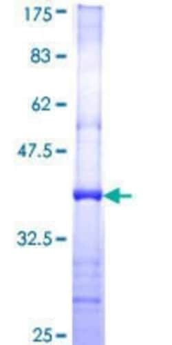Novus Biologicals Recombinant Human PIK4CA GST (N-Term) Protein 10 &mu;g | Buy Online | Novus Biologicals&trade; | Fisher Scientific