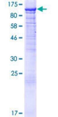 Novus Biologicals Recombinant Human PI4KB/PI4KIII beta GST (N-Term) Protein 25 &mu;g | Buy Online | Novus Biologicals&trade; | Fisher Scientific
