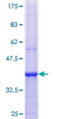 Novus Biologicals Recombinant Human PI4KB/PI4KIII beta GST (N-Term) Protein 25 &mu;g | Buy Online | Novus Biologicals&trade; | Fisher Scientific