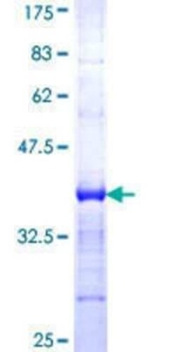 Novus Biologicals Recombinant Human PITX1 GST (N-Term) Protein 10 &mu;g | Buy Online | Novus Biologicals&trade; | Fisher Scientific