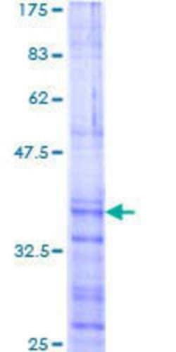 Novus Biologicals Recombinant Human PITX2 GST (N-Term) Protein 25 &mu;g | Buy Online | Novus Biologicals&trade; | Fisher Scientific