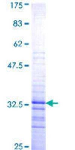 Novus Biologicals Recombinant Human PITX2 GST (N-Term) Protein 2 &mu;g | Buy Online | Novus Biologicals&trade; | Fisher Scientific