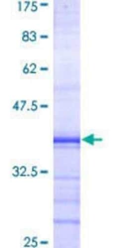 Novus Biologicals Recombinant Human Polycystin 2 GST (N-Term) Protein 10 &mu;g | Buy Online | Novus Biologicals&trade; | Fisher Scientific