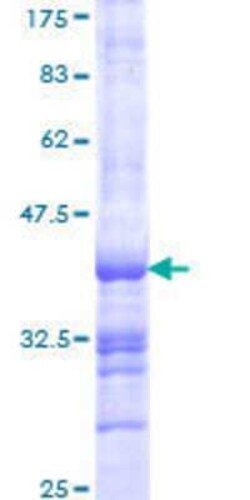 Novus Biologicals Recombinant Human Plakophilin 1 GST (N-Term) Protein 25 &mu;g | Buy Online | Novus Biologicals&trade; | Fisher Scientific