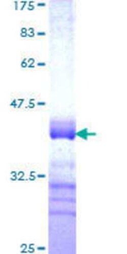 Novus Biologicals Recombinant Human PLAGL2 GST (N-Term) Protein 25 &mu;g | Buy Online | Novus Biologicals&trade; | Fisher Scientific