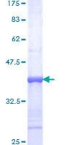 Novus Biologicals Recombinant Human Phospholipase C delta 1 GST (N-Term) Protein 10 &mu;g | Buy Online | Novus Biologicals&trade; | Fisher Scientific