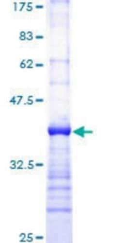 Novus Biologicals Recombinant Human PLC-gamma 1 GST (N-Term) Protein 10 &mu;g | Buy Online | Novus Biologicals&trade; | Fisher Scientific