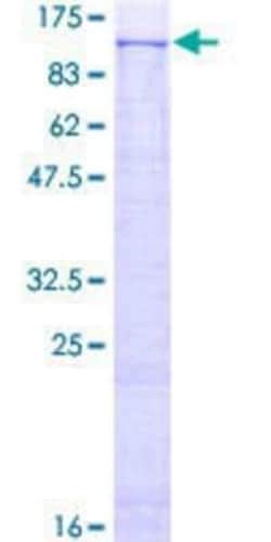 Novus Biologicals™ Recombinant Human Phospholipase D2 GST (N-Term) Protein