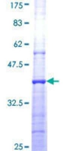 Novus Biologicals Recombinant Human Phospholipase D2 GST (N-Term) Protein 25 &mu;g | Buy Online | Novus Biologicals&trade; | Fisher Scientific