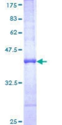 Novus Biologicals Recombinant Human Plectin GST (N-Term) Protein 25 &mu;g | Buy Online | Novus Biologicals&trade; | Fisher Scientific