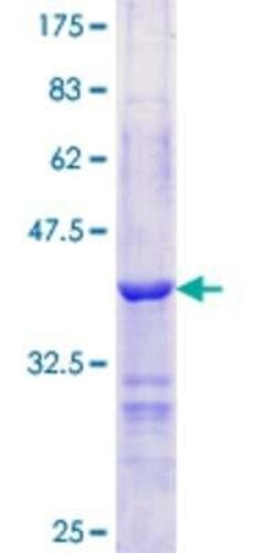 Novus Biologicals Recombinant Human Perilipin GST (N-Term) Protein 25 &mu;g | Buy Online | Novus Biologicals&trade; | Fisher Scientific
