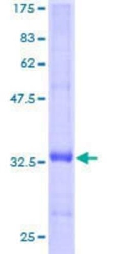 Novus Biologicals Recombinant Human FXYD3 GST (N-Term) Protein 25 &mu;g | Buy Online | Novus Biologicals&trade; | Fisher Scientific