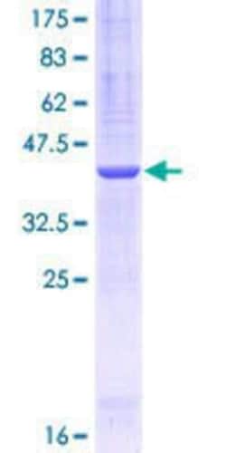 R&D Systems&trade;&nbsp;Recombinant Human PLOD1 GST (N-Term) Protein