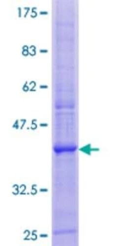 Novus Biologicals Recombinant Human PLP2 GST (N-Term) Protein 10 &mu;g | Buy Online | Novus Biologicals&trade; | Fisher Scientific