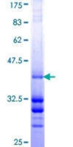 Novus Biologicals Recombinant Human PLRG1 GST (N-Term) Protein 10 &mu;g | Buy Online | Novus Biologicals&trade; | Fisher Scientific