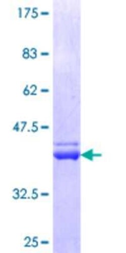 Novus Biologicals Recombinant Human PLS1 GST (N-Term) Protein 10 &mu;g | Buy Online | Novus Biologicals&trade; | Fisher Scientific