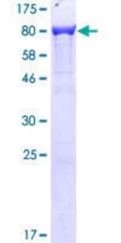 Novus Biologicals&trade;&nbsp;Recombinant Human T Plastin GST (N-Term) Protein