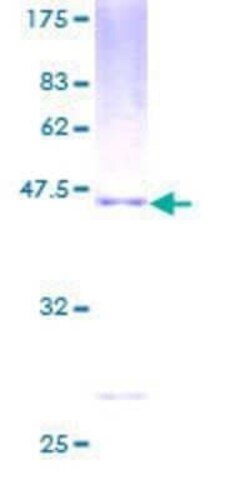 Novus Biologicals Recombinant Human PMCH GST (N-Term) Protein 2 &mu;g | Buy Online | Novus Biologicals&trade; | Fisher Scientific