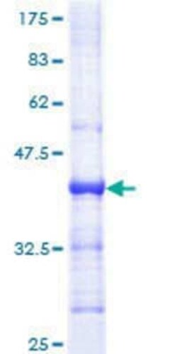 Novus Biologicals Recombinant Human PMS1 GST (N-Term) Protein 25 &mu;g | Buy Online | Novus Biologicals&trade; | Fisher Scientific
