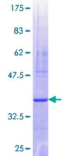 Novus Biologicals Recombinant Human Exosome component 10 GST (N-Term) Protein 10 &mu;g | Buy Online | Novus Biologicals&trade; | Fisher Scientific