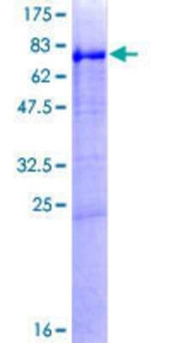 Novus Biologicals Recombinant Human PLRP1 GST (N-Term) Protein 2 &mu;g | Buy Online | Novus Biologicals&trade; | Fisher Scientific