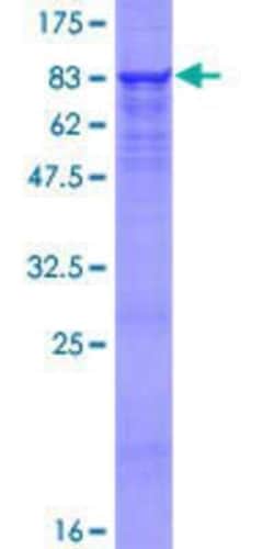 Novus Biologicals Recombinant Human Pancreatic Lipase Related Protein 2 GST (N-Term) Protein 25 &mu;g | Buy Online | Novus Biologicals&trade; | Fisher Scientific