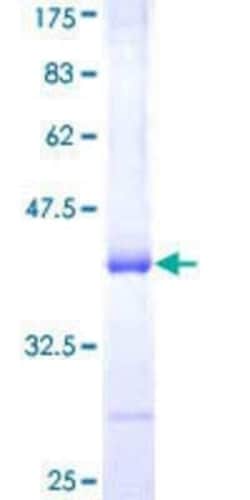 Novus Biologicals Recombinant Human Pancreatic Lipase Related Protein 2 GST (N-Term) Protein 25 &mu;g | Buy Online | Novus Biologicals&trade; | Fisher Scientific
