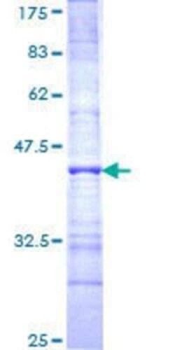 Novus Biologicals Recombinant Human Pinin GST (N-Term) Protein 25 &mu;g | Buy Online | Novus Biologicals&trade; | Fisher Scientific