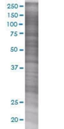 Novus Biologicals Septin-4 293T Cell Transient Overexpression Lysate 0.1 mL | Buy Online | Novus Biologicals&trade; | Fisher Scientific
