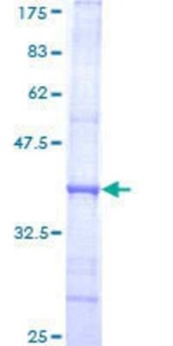 Novus Biologicals Recombinant Human DNA polymerase alpha GST (N-Term) Protein 10 &mu;g | Buy Online | Novus Biologicals&trade; | Fisher Scientific