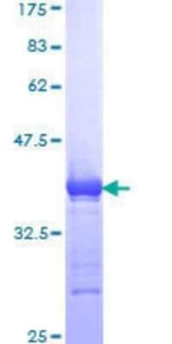 Novus Biologicals Recombinant Human DNA Polymerase epsilon p59 GST (N-Term) Protein 10 &mu;g | Buy Online | Novus Biologicals&trade; | Fisher Scientific