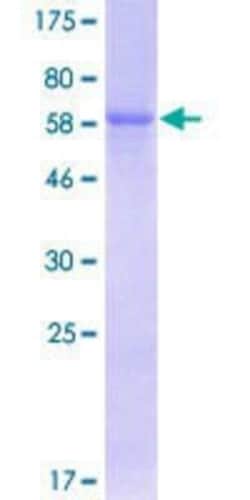 Novus Biologicals™ Recombinant Human PON3 GST (N-Term) Protein