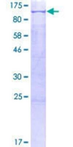 Novus Biologicals Recombinant Human OCT1 GST (N-Term) Protein 2 &mu;g | Buy Online | Novus Biologicals&trade; | Fisher Scientific