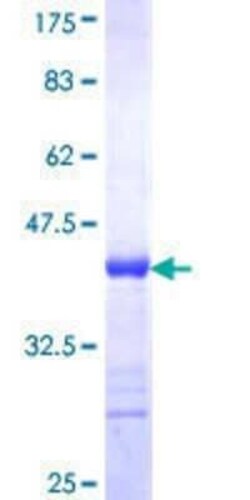 Novus Biologicals Recombinant Human POU3F3 GST (N-Term) Protein 25 &mu;g | Buy Online | Novus Biologicals&trade; | Fisher Scientific