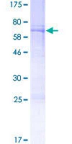 Novus Biologicals Recombinant Human BRN4 GST (N-Term) Protein 2 &mu;g | Buy Online | Novus Biologicals&trade; | Fisher Scientific