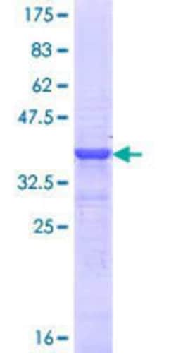 Novus Biologicals Recombinant Human BRN3A GST (N-Term) Protein 25 &mu;g | Buy Online | Novus Biologicals&trade; | Fisher Scientific