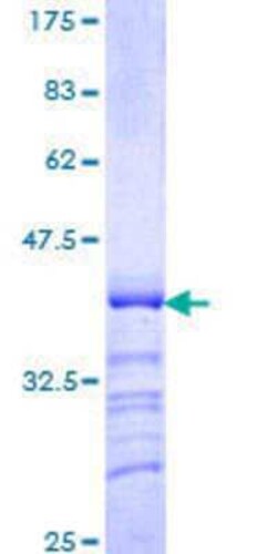 Novus Biologicals Recombinant Human POU4F3 GST (N-Term) Protein 10 &mu;g | Buy Online | Novus Biologicals&trade; | Fisher Scientific