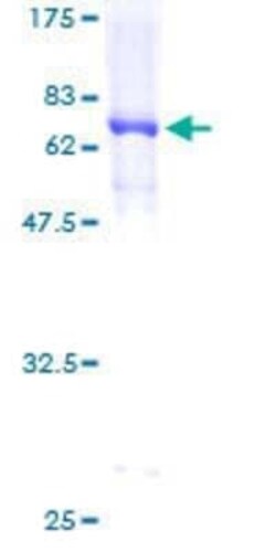 Novus Biologicals Recombinant Human PPAR delta/NR1C2 GST (N-Term) Protein 2 &mu;g | Buy Online | Novus Biologicals&trade; | Fisher Scientific
