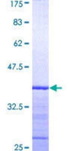 Novus Biologicals Recombinant Human PPOX GST (N-Term) Protein 25 &mu;g | Buy Online | Novus Biologicals&trade; | Fisher Scientific