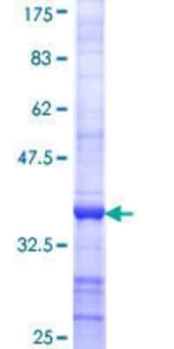 Novus Biologicals Recombinant Human Protein Phosphatase 1 beta GST (N-Term) Protein 10 &mu;g | Buy Online | Novus Biologicals&trade; | Fisher Scientific