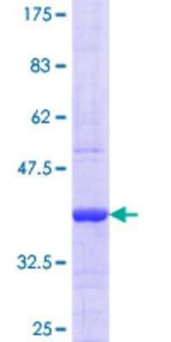 Novus Biologicals Recombinant Human PPP1R3C GST (N-Term) Protein 10 &mu;g | Buy Online | Novus Biologicals&trade; | Fisher Scientific