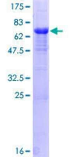 Novus Biologicals Recombinant Human PPP1R7 GST (N-Term) Protein 10 &mu;g | Buy Online | Novus Biologicals&trade; | Fisher Scientific