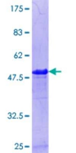 Novus Biologicals Recombinant Human PPP1R7 GST (N-Term) Protein 10 &mu;g | Buy Online | Novus Biologicals&trade; | Fisher Scientific