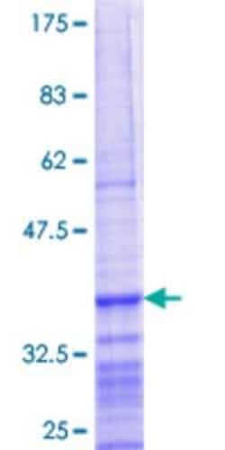 Novus Biologicals Recombinant Human PNUTS/PPP1R10 GST (N-Term) Protein 25 &mu;g | Buy Online | Novus Biologicals&trade; | Fisher Scientific