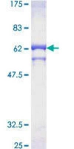 Novus Biologicals Recombinant Human PPP2CB GST (N-Term) Protein 10 &mu;g | Buy Online | Novus Biologicals&trade; | Fisher Scientific