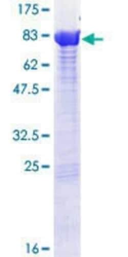Novus Biologicals Recombinant Human PPP2R1B GST (N-Term) Protein 25 &mu;g | Buy Online | Novus Biologicals&trade; | Fisher Scientific