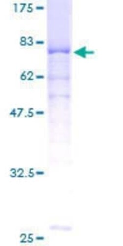 Novus Biologicals Recombinant Human PPP2R2A GST (N-Term) Protein 25 &mu;g | Buy Online | Novus Biologicals&trade; | Fisher Scientific