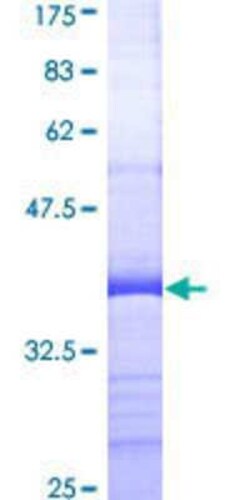 Novus Biologicals Recombinant Human PPP2R2B GST (N-Term) Protein 25 &mu;g | Buy Online | Novus Biologicals&trade; | Fisher Scientific