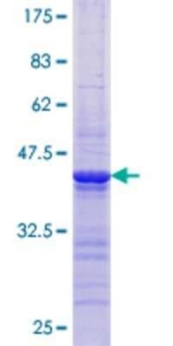 Novus Biologicals Recombinant Human PPP2R2B GST (N-Term) Protein 10 &mu;g | Buy Online | Novus Biologicals&trade; | Fisher Scientific